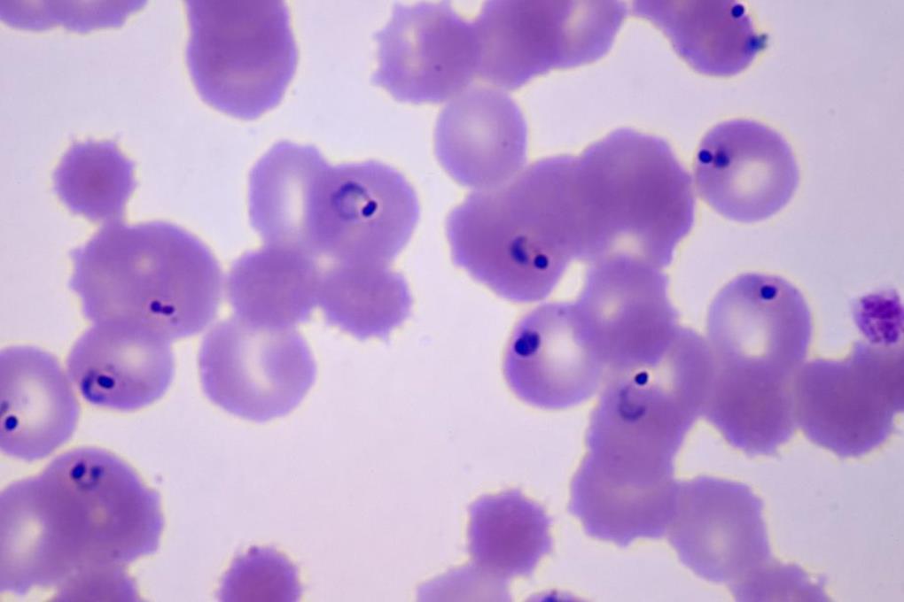 Малярия дала ключ к лечению рака